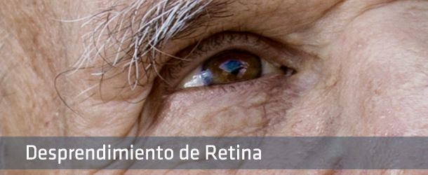 Cirugía Desprendimiento de Retina - IO·ICO Barcelona