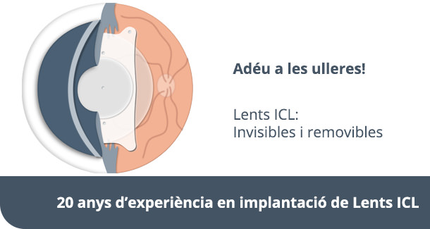 Lents ICL - Eliminar ulleres - IO·ICO Barcelona