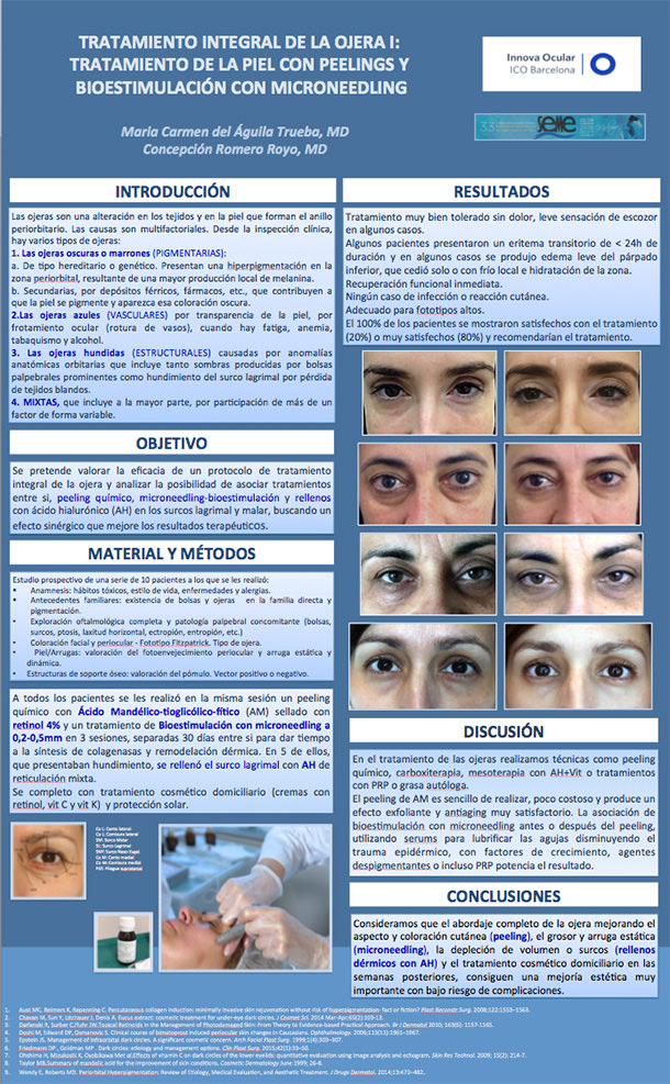 Poster Dra. Carmen Del Águila - Tratamiento Integral de la ojera - Innova Ocular ICO Barcelona