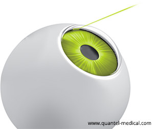 Trabeculoplastia Láser Selectiva- Glaucoma - SLT- IO·ICO Barcelona